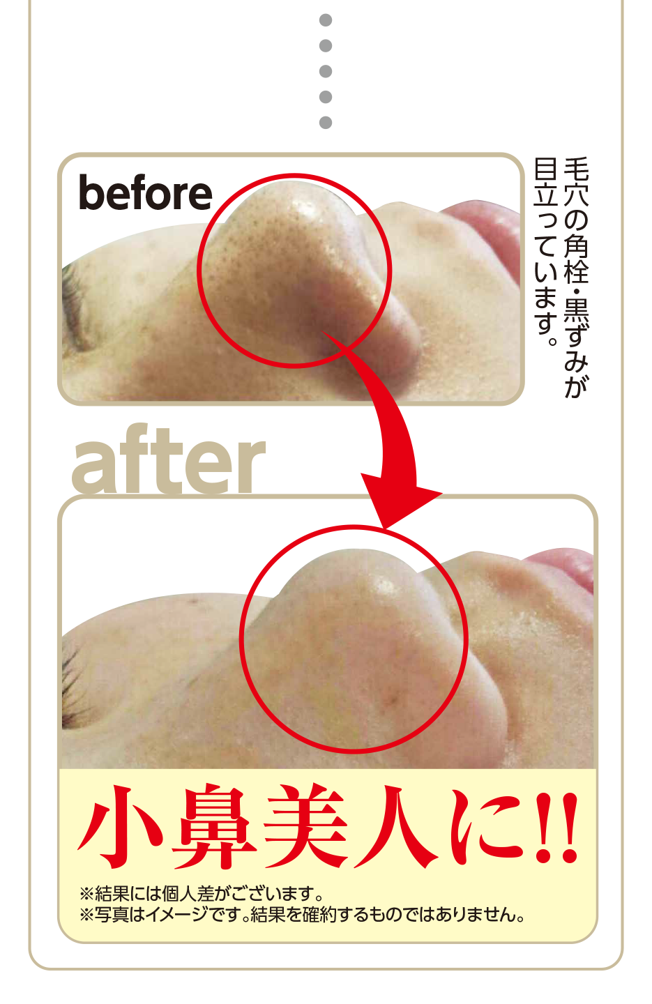 エステココ 毛穴ケア 黒ずみ 汚れ